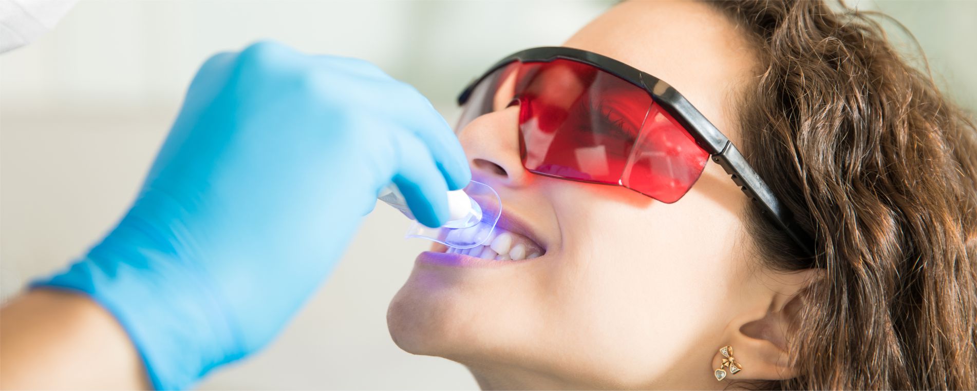 Learn About Teeth Whitening And Beauty Services Using CallHealer